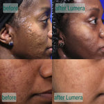 Microcrystal™ Serum PM Duo