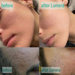 Microcrystal™ Serum PM Duo