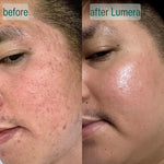 Microcrystal™ Serum PM Duo