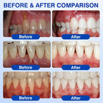 Periodontal Repair Gel