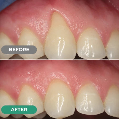 Your Gumline Is Losing The Fight Every Time You Brush